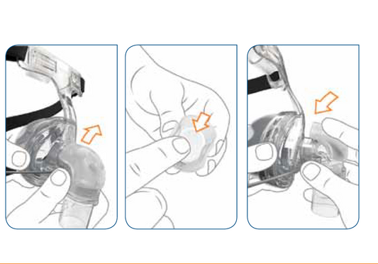 Fisher & Paykel Zest Q Neusmasker met uitgeademde luchtverdeler - Neus CPAP Slaaptherapiemasker