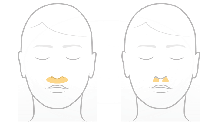 Fisher & Paykel Solo Nasal Cushion CPAP Mask